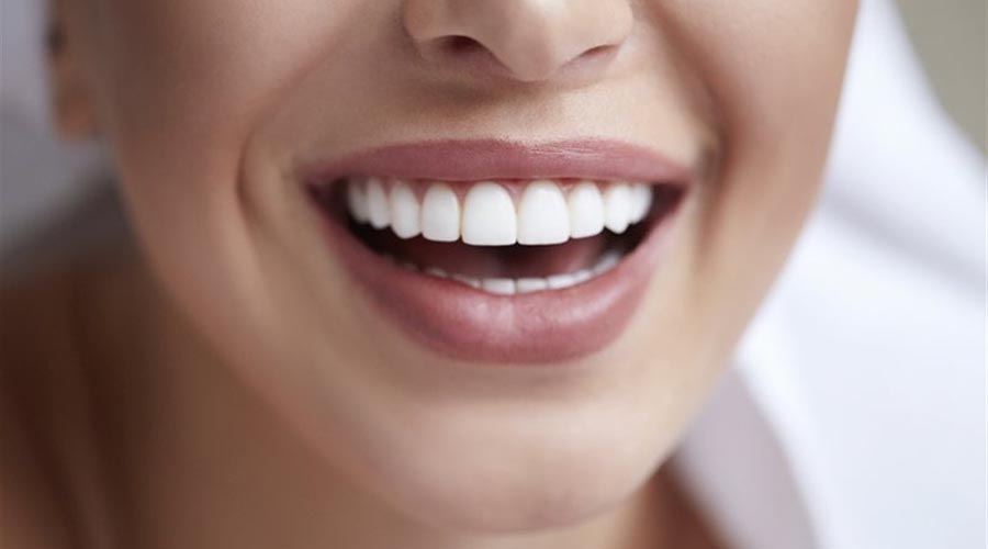 Как отбелить зубы дома | добиваемся красивой улыбки [ВИДЕО]